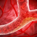 US Cardiologists Have Just Published New Guidelines For Managing Cholesterol