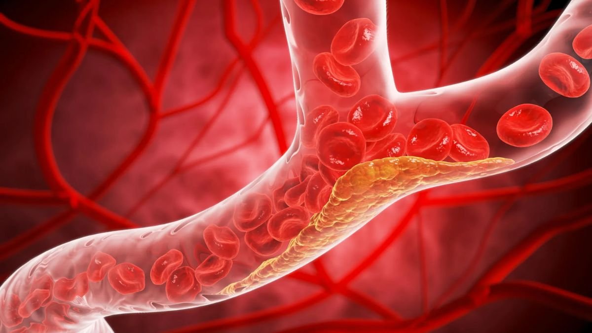US Cardiologists Have Just Published New Guidelines For Managing Cholesterol